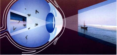 IMMAGINE 2 PRODOTTA DALL'OCCHIO